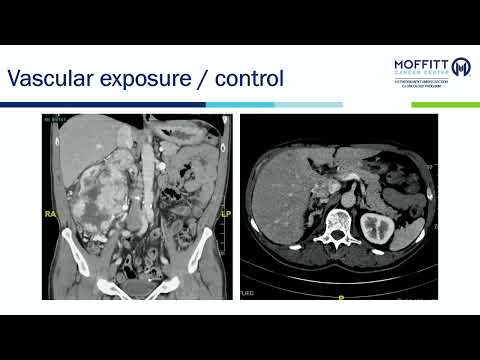 IS01: The Evolution of Surgery Sponsored by Medtronic