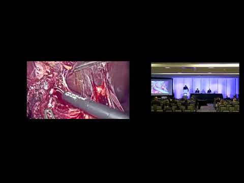 FP03: Liver Transplant 1