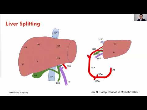 FP07: Liver Transplant 2