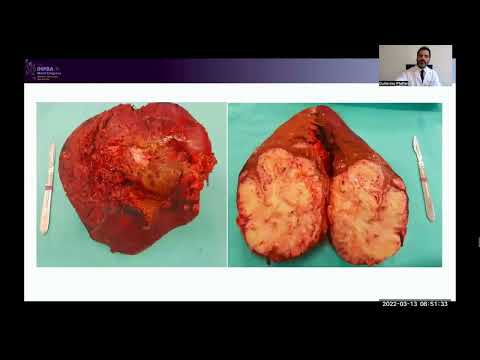 FP17: Tricks of the Trade