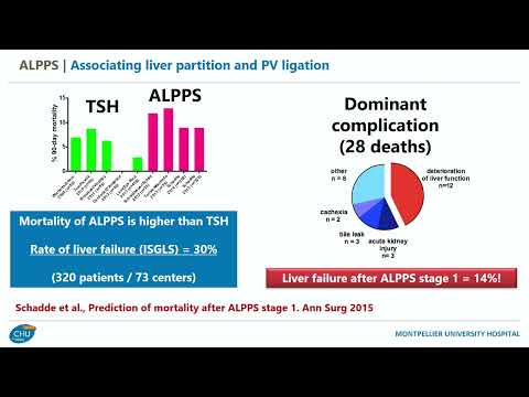 DEB04: Failed PVE ALPPS vs Hepatic Vein Embolization