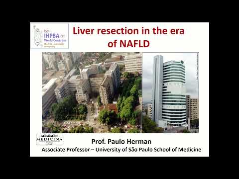US06: Liver Resection in the Era of NAFLD