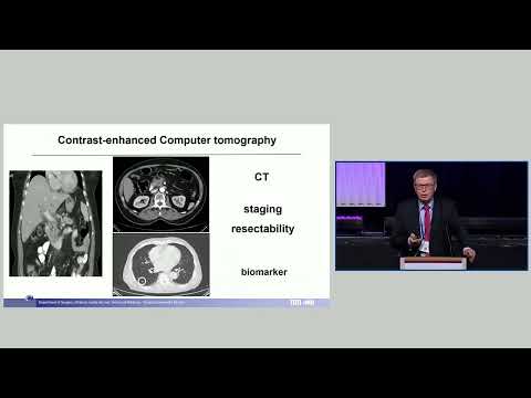 US08: Novel Biomarkers that Predict Outcomes in Patients Undergoing Surgery for Pancreatic Cancer